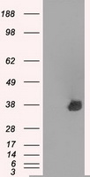 AURKC / Aurora C Antibody - HEK293T cells were transfected with the pCMV6-ENTRY control (Left lane) or pCMV6-ENTRY AURKC (Right lane) cDNA for 48 hrs and lysed. Equivalent amounts of cell lysates (5 ug per lane) were separated by SDS-PAGE and immunoblotted with anti-AURKC.