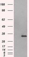 AURKC / Aurora C Antibody - HEK293T cells were transfected with the pCMV6-ENTRY control (Left lane) or pCMV6-ENTRY AURKC (Right lane) cDNA for 48 hrs and lysed. Equivalent amounts of cell lysates (5 ug per lane) were separated by SDS-PAGE and immunoblotted with anti-AURKC.