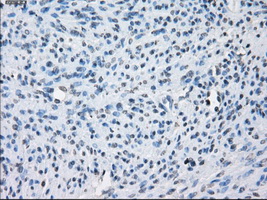 AURKC / Aurora C Antibody - Immunohistochemical staining of paraffin-embedded endometrium tissue using anti-AURKC mouse monoclonal antibody. (Dilution 1:50).