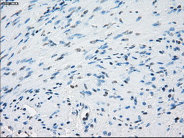 AURKC / Aurora C Antibody - Immunohistochemical staining of paraffin-embedded prostate tissue using anti-AURKC mouse monoclonal antibody. (Dilution 1:50).