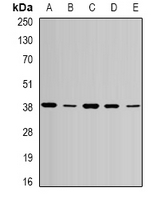 AURKC / Aurora C Antibody - Western blot analysis of ARK3 expression in SW620 (A); HepG2 (B); mouse testis (C); mouse ovary (D); rat brain (E) whole cell lysates.