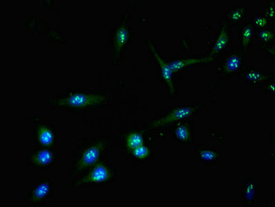 AURKC / Aurora C Antibody - Immunofluorescent analysis of Hela cells at a dilution of 1:100 and Alexa Fluor 488-congugated AffiniPure Goat Anti-Rabbit IgG(H+L)