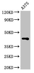 AURKC / Aurora C Antibody - Positive Western Blot detected in A375 whole cell lysate. All lanes: AURKC antibody at 3.2 µg/ml Secondary Goat polyclonal to rabbit IgG at 1/50000 dilution. Predicted band size: 36, 33, 34 KDa. Observed band size: 45 KDa