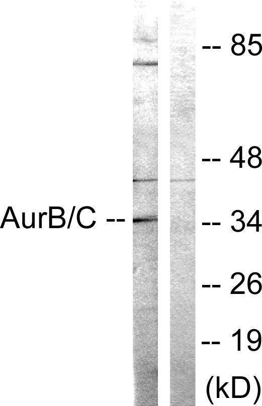 Aurora Kinase B+C Antibody - Western blot analysis of extracts from 293 cells, treated with Paclitaxel (1uM, 24hours), using AurB/C (Ab-202/175) antibody.