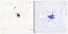 Aurora Kinase B+C Antibody - Immunohistochemistry analysis of paraffin-embedded human brain, using AurB/C (Phospho-Thr236/202) Antibody. The picture on the right is blocked with the phospho peptide.