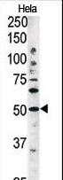 AUTL1 / ATG4C Antibody - The anti-APG4C antibody is used in Western blot to detect APG4C in HeLa tissue lysate