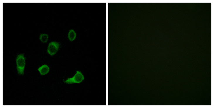 AUTL1 / ATG4C Antibody - Immunofluorescence analysis of HUVEC cells, using ATG4C Antibody. The picture on the right is blocked with the synthesized peptide.