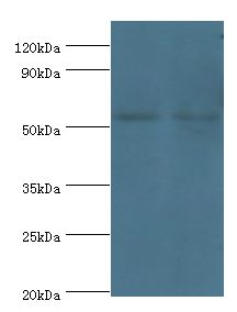 AUTL1 / ATG4C Antibody - Western blot. All lanes: ATG4C antibody at 9 ug/ml. Lane 1: mouse lung tissue. Lane 2: HepG2 whole cell lysate. Secondary antibody: Goat polyclonal to rabbit at 1:10000 dilution. Predicted band size: 52 kDa. Observed band size: 52 kDa.