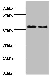 AUTL1 / ATG4C Antibody - Western blot All lanes: ATG4C antibody at 9µg/ml Lane 1: Mouse lung tissue Lane 2: HepG2 whole cell lysate Secondary Goat polyclonal to rabbit IgG at 1/10000 dilution Predicted band size: 52 kDa Observed band size: 52 kDa