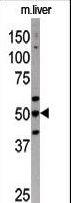 AUTL1 / ATG4C Antibody - The anti-APG4C antibody is used in Western blot to detect APG4C in mouse liver tissue lysate