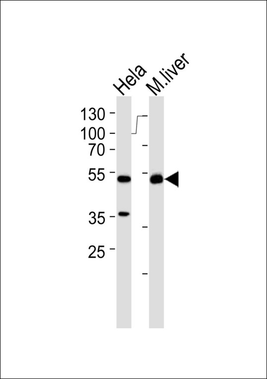 AUTL1 / ATG4C Antibody - Western blot of lysates from HeLa cell line and mouse liver tissue lysate(from left to right), using APG4C Antibody. Antibody was diluted at 1:1000 at each lane. A goat anti-rabbit IgG H&L (HRP) at 1:5000 dilution was used as the secondary antibody. Lysates at 35ug per lane.