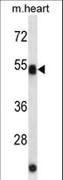 AUTL1 / ATG4C Antibody - ATG4C Antibody western blot of mouse heart tissue lysates (35 ug/lane). The ATG4C antibody detected the ATG4C protein (arrow).