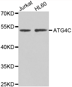 AUTL1 / ATG4C Antibody - Western blot analysis of extracts of various cell lines.