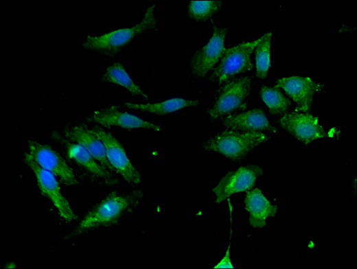 AUTL1 / ATG4C Antibody - Immunofluorescent analysis of Hela cells using ATG4C Antibody at a dilution of 1:100 and Alexa Fluor 488-congugated AffiniPure Goat Anti-Rabbit IgG(H+L)