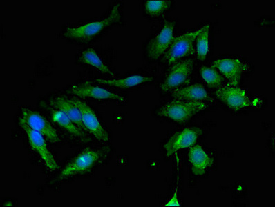 AUTL1 / ATG4C Antibody - Immunofluorescent analysis of Hela cells using ATG4C Antibody at dilution of 1:100 and Alexa Fluor 488-congugated AffiniPure Goat Anti-Rabbit IgG(H+L)