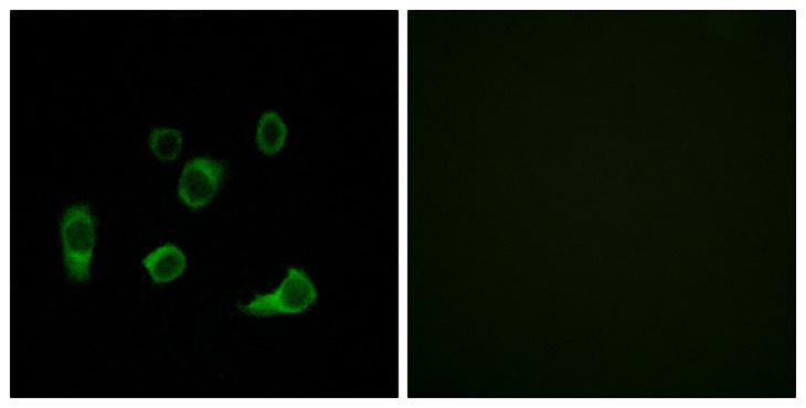 AUTL1 / ATG4C Antibody - Peptide - + Immunofluorescence analysis of HuvEc cells, using ATG4C antibody.