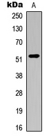 AUTL1 / ATG4C Antibody - Western blot analysis of ATG4C expression in K562 (A) whole cell lysates.