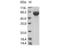 AcNPV gp64 Protein - Recombinant AcmNPV Envelope glycoprotein gp64(His Tag)