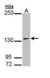 AUTS2 Antibody - Sample (30 ug of whole cell lysate). A: 293T. 7.5% SDS PAGE. AUTS2 antibody diluted at 1:1000