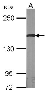 AUTS2 Antibody - Sample (30 ug of whole cell lysate). A: NIH-3T3. 5% SDS PAGE. AUTS2 antibody diluted at 1:1000.
