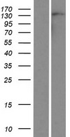 AUTS2 Protein - Western validation with an anti-DDK antibody * L: Control HEK293 lysate R: Over-expression lysate