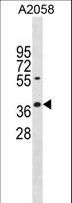 AVEN / PDCD12 Antibody - AVEN Antibody western blot of A2058 cell line lysates (35 ug/lane). The AVEN antibody detected the AVEN protein (arrow).