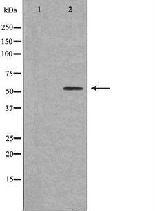 AVEN / PDCD12 Antibody - Western blot analysis of extracts of LOVO cells using AVEN antibody. The lane on the left is treated with the antigen-specific peptide.
