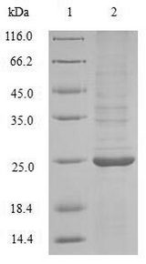 Endochitinase Protein - (Tris-Glycine gel) Discontinuous SDS-PAGE (reduced) with 5% enrichment gel and 15% separation gel.