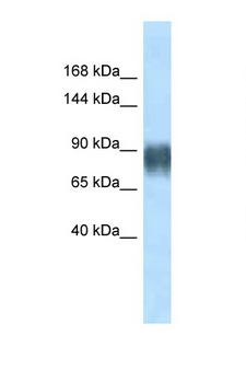 AVIL / Advillin Antibody - AVIL / Advillin antibody Western blot of Rat Muscle lysate. Antibody concentration 1 ug/ml.  This image was taken for the unconjugated form of this product. Other forms have not been tested.