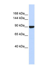 AVIL / Advillin Antibody - AVIL / Advillin antibody Western blot of Fetal Liver lysate. This image was taken for the unconjugated form of this product. Other forms have not been tested.