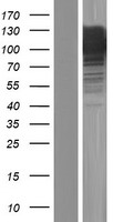 AVIL / Advillin Protein - Western validation with an anti-DDK antibody * L: Control HEK293 lysate R: Over-expression lysate
