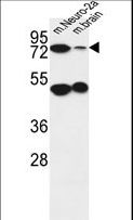 AVL9 Antibody - AVL9 Antibody western blot of mouse Neuro-2a cell line and mouse brain tissue lysates (35 ug/lane). The AVL9 antibody detected the AVL9 protein (arrow).