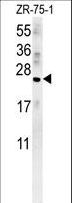 AVP / ADH / Vasopressin Antibody - AVP Antibody western blot of ZR-75-1 cell line lysates (15 ug/lane). The AVP antibody detected the AVP protein (arrow).