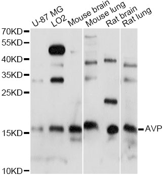 AVP / ADH / Vasopressin Antibody - Western blot analysis of extracts of various cell lines, using AVP antibody at 1:1000 dilution. The secondary antibody used was an HRP Goat Anti-Rabbit IgG (H+L) at 1:10000 dilution. Lysates were loaded 25ug per lane and 3% nonfat dry milk in TBST was used for blocking. An ECL Kit was used for detection and the exposure time was 60s.