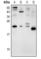 AVP / ADH / Vasopressin Antibody - Western blot analysis of AVP expression in HEK293T (A), COS7 (B), PC12 (C), CT26 (D) whole cell lysates.