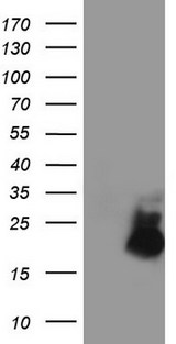 AVPI1 Antibody - HEK293T cells were transfected with the pCMV6-ENTRY control (Left lane) or pCMV6-ENTRY AVPI1 (Right lane) cDNA for 48 hrs and lysed. Equivalent amounts of cell lysates (5 ug per lane) were separated by SDS-PAGE and immunoblotted with anti-AVPI1.