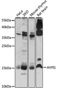 AVPI1 Antibody - Western blot analysis of extracts of various cell lines, using AVPI1 antibody at 1:1000 dilution. The secondary antibody used was an HRP Goat Anti-Rabbit IgG (H+L) at 1:10000 dilution. Lysates were loaded 25ug per lane and 3% nonfat dry milk in TBST was used for blocking. An ECL Kit was used for detection and the exposure time was 30s.