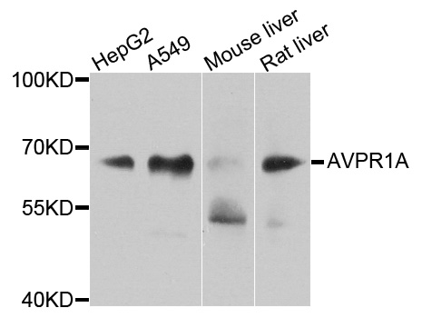 AVPR1A / V1a Receptor Antibody - Western blot analysis of extracts of various cells.