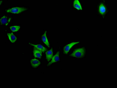AVPR1A / V1a Receptor Antibody - Immunofluorescence staining of A549 cells diluted at 1:133, counter-stained with DAPI. The cells were fixed in 4% formaldehyde, permeabilized using 0.2% Triton X-100 and blocked in 10% normal Goat Serum. The cells were then incubated with the antibody overnight at 4°C.The Secondary antibody was Alexa Fluor 488-congugated AffiniPure Goat Anti-Rabbit IgG (H+L).