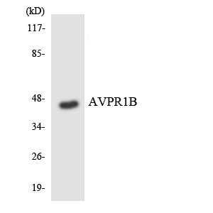 AVPR1B Antibody - Western blot of the lysates from HUVEC cells using AVPR1B antibody.