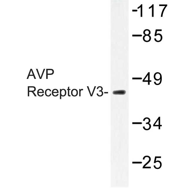 AVPR1B Antibody - Western blot of AVP Receptor V3 (D314) pAb in extracts from COLO/HepG2 cells.
