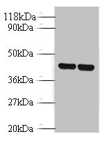 AVPR1B Antibody - Western blot All lanes: Vasopressin V1b receptor antibody at 2µg/ml Lane 1: EC109 whole cell lysate Lane 2: 293T whole cell lysate Secondary Goat polyclonal to rabbit IgG at 1/10000 dilution Predicted band size: 47 kDa Observed band size: 47 kDa