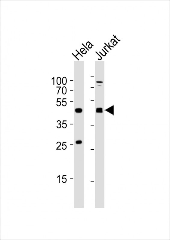 AVPR2 / V2R Antibody - All lanes : Anti-AVPR2 Antibody at 1:2000 dilution Lane 1: HeLa whole cell lysates Lane 2: Jurkat whole cell lysates Lysates/proteins at 20 ug per lane. Secondary Goat Anti-Rabbit IgG, (H+L), Peroxidase conjugated at 1/10000 dilution Predicted band size : 40 kDa Blocking/Dilution buffer: 5% NFDM/TBST.