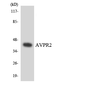 AVPR2 / V2R Antibody - Western blot analysis of the lysates from Jurkat cells using AVPR2 antibody.