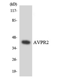 AVPR2 / V2R Antibody - Western blot analysis of the lysates from Jurkat cells using AVPR2 antibody.