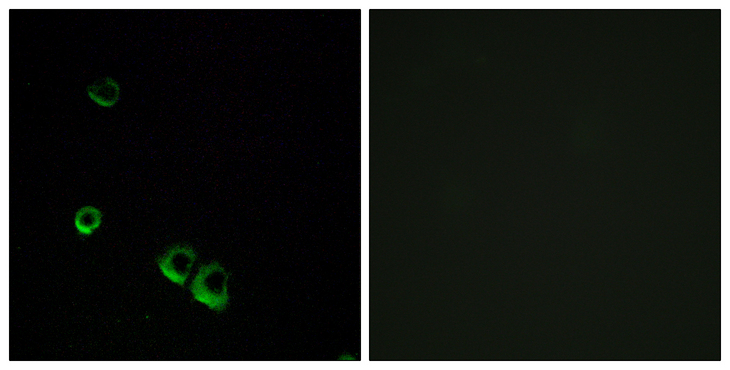 AVPR2 / V2R Antibody - Immunofluorescence analysis of MCF7 cells, using AVPR2 Antibody. The picture on the right is blocked with the synthesized peptide.