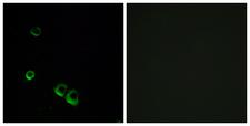 AVPR2 / V2R Antibody - Immunofluorescence analysis of MCF7 cells, using AVPR2 Antibody. The picture on the right is blocked with the synthesized peptide.