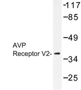 AVPR2 / V2R Antibody - Western blot of AVP Receptor V2 (L111) pAb in extracts from RAW264.7 cells.