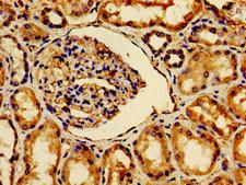 AVPR2 / V2R Antibody - Immunohistochemistry image of paraffin-embedded human kidney tissue at a dilution of 1:100
