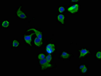 AVPR2 / V2R Antibody - Immunofluorescence staining of MCF-7 cells with AVPR2 Antibody at 1:200, counter-stained with DAPI. The cells were fixed in 4% formaldehyde, permeabilized using 0.2% Triton X-100 and blocked in 10% normal Goat Serum. The cells were then incubated with the antibody overnight at 4°C. The secondary antibody was Alexa Fluor 488-congugated AffiniPure Goat Anti-Rabbit IgG(H+L).